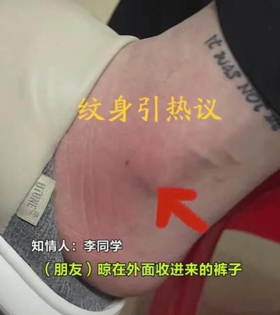 最新马蜂蜇伤治疗科技，告别疼痛，拥抱健康新生活